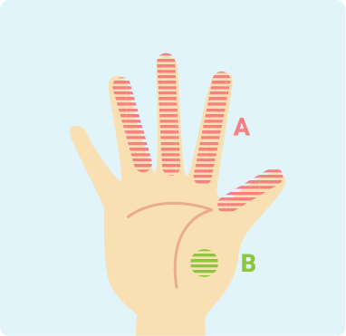 手根管症候群の説明図